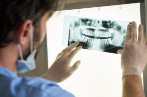 5 Reasons You Need Dental X-Rays Morrisville