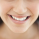 7 Reasons Why You Should Choose Invisalign Over Standard Braces