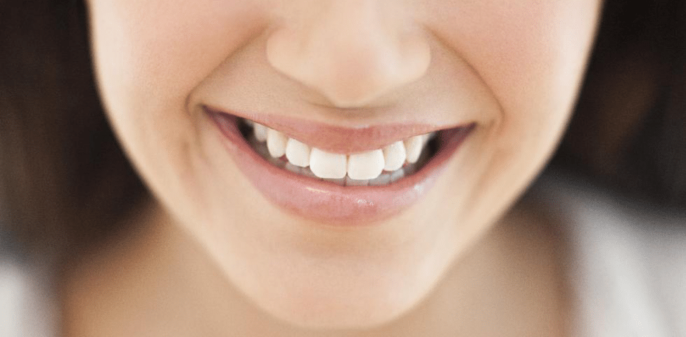 7 Reasons Why You Should Choose Invisalign Over Standard Braces
